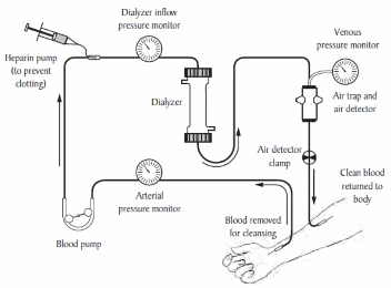 Diagram of a dialysis machine